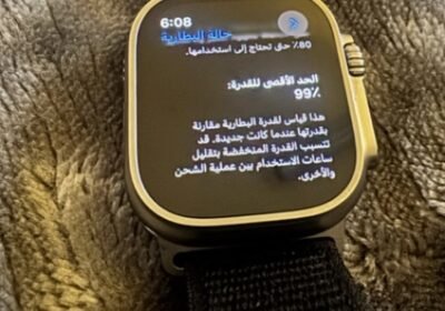 6656369