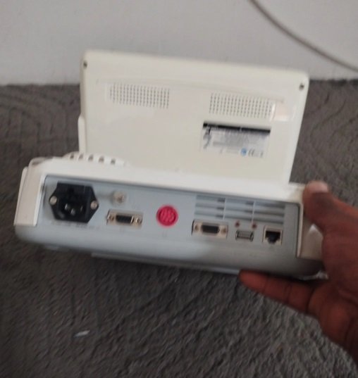 جهاز قياس نبض الجنين