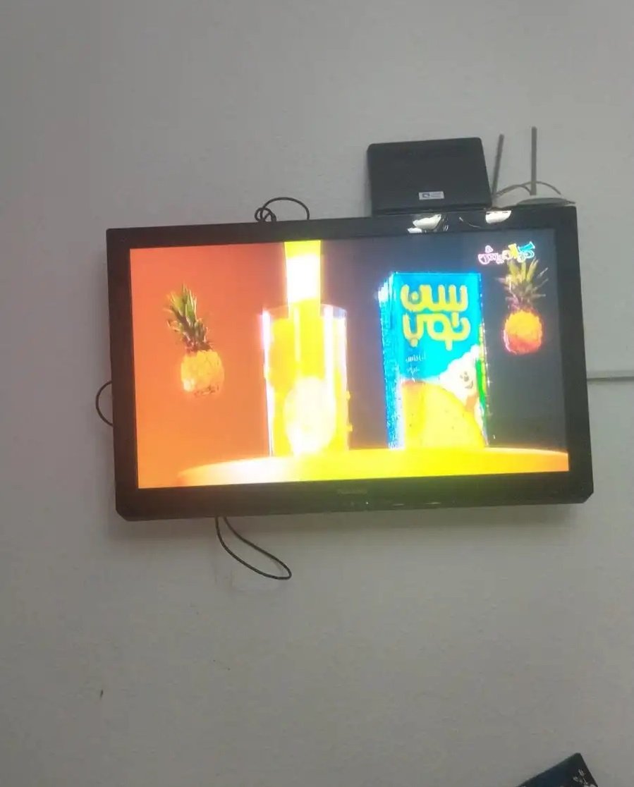 تلفزيون عادي